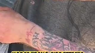 Breaking: Horse Tranq Side Effects #addiction #thestreets #addict #viral