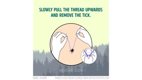 17 IMPORTANT SURVIVAL HACKS THAT CAN SAVE YOUR LIFE
