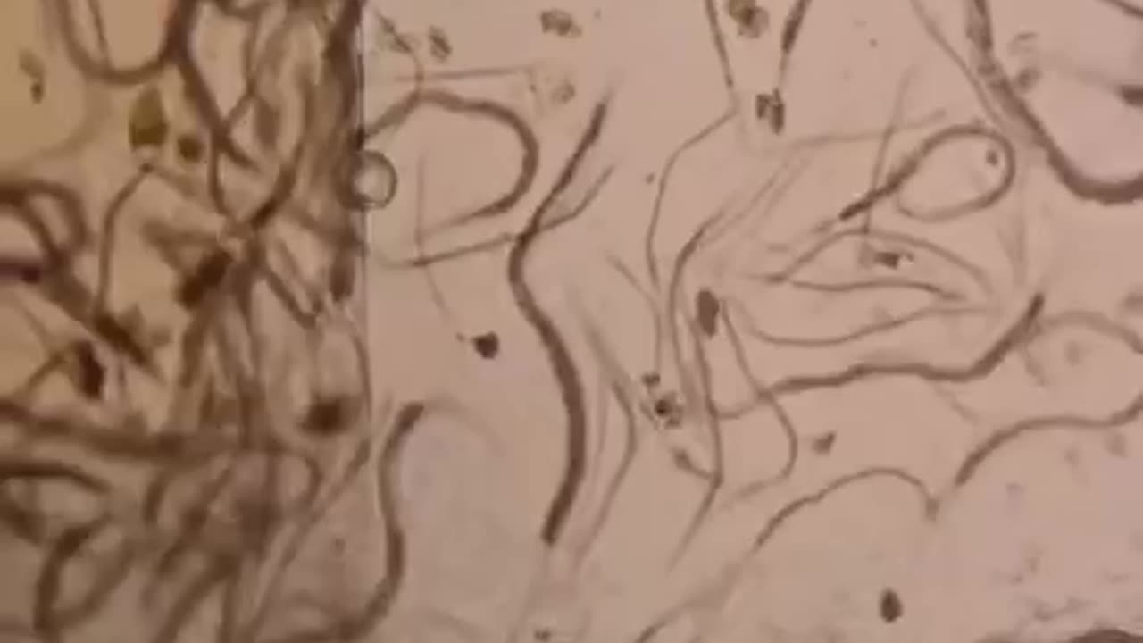 Parasite natural treatment