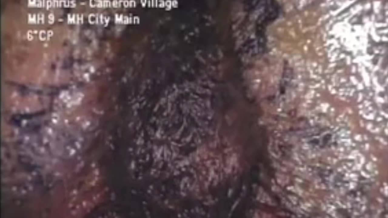 🧠✨ The Carolina Poop Monster: Bizarre Sewer Blob Revealed! | FeedMyCuriosity