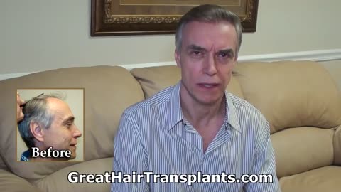 Dr. Brett Bolton – Excellent Hair Implant Physician in Miami, Florida – Promo
