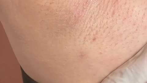 Underarm Waxing in Nevada Using Sexy Smooth Tickled Pink Hard Wax | @_veautybyvee_ Demo