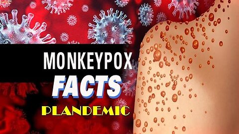 "Unveiling the Truth: The Monkey Pox (Mpox) Pandemic"