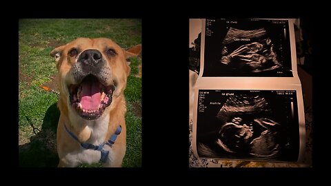 Yard #2 | Helping a Filmmaker in Need | The Aestheticlawns Project