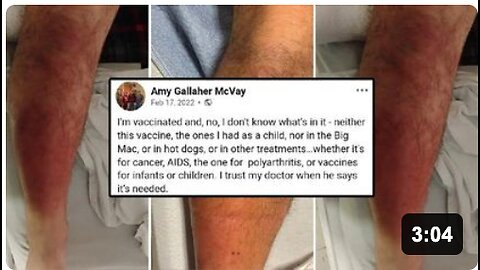 Amy then: We don't care what's in the vaccines. Amy now: Spent 50K+ at the hospital!
