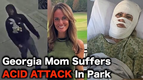 White Mom ATTACKED With Acid In Savannah Park