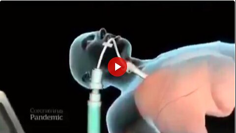 Murder by Ventilator. It is happening all across this country as a way to treat Covid.