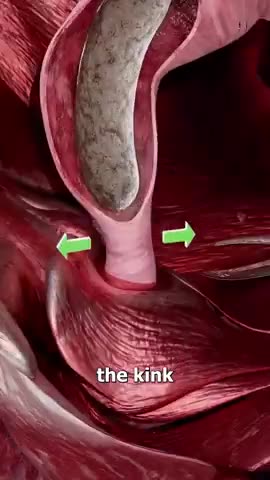 How the modern toilet have wrecked peoples health