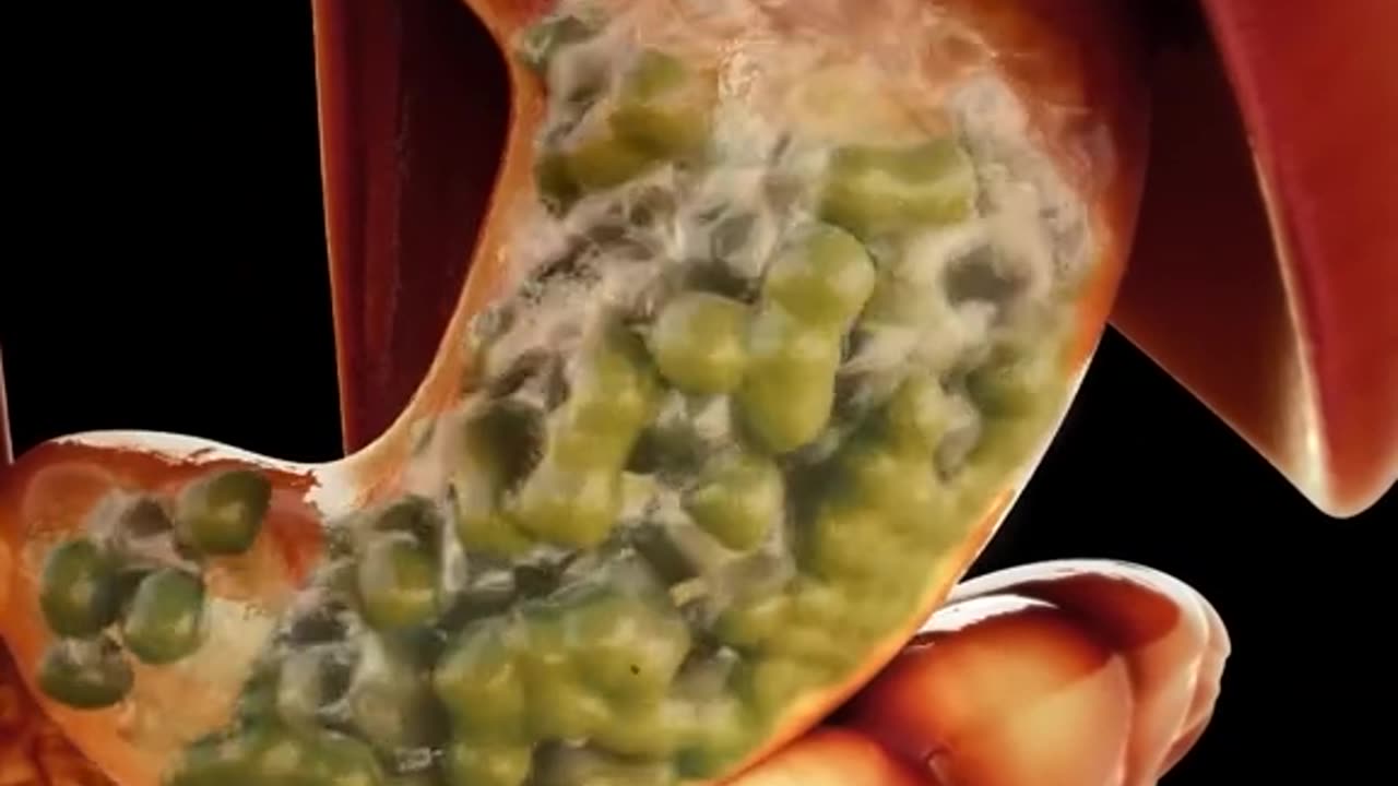 How Alcohol Damage Our Body