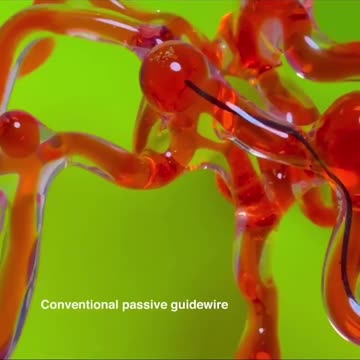 MIT Engineers Develop Magnetic Robotic Thread to Clear Brain Blood Clots