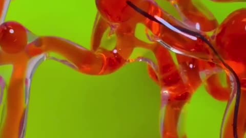MIT Engineers Develop Magnetic Robotic Thread to Clear Brain Blood Clots