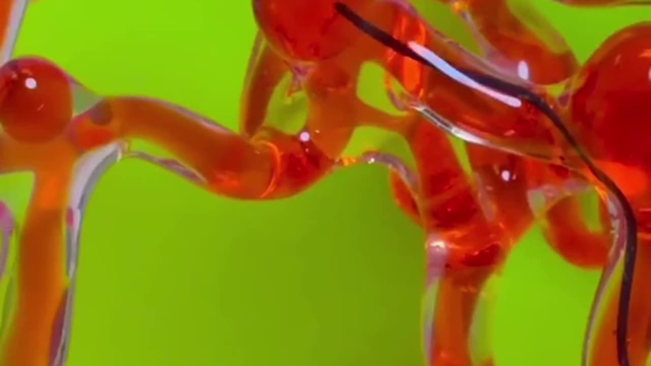 MIT Engineers Develop Magnetic Robotic Thread to Clear Brain Blood Clots