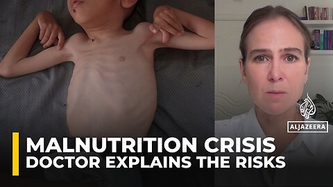 Doctor explains why refeeding malnourished patients can be life-threatening
