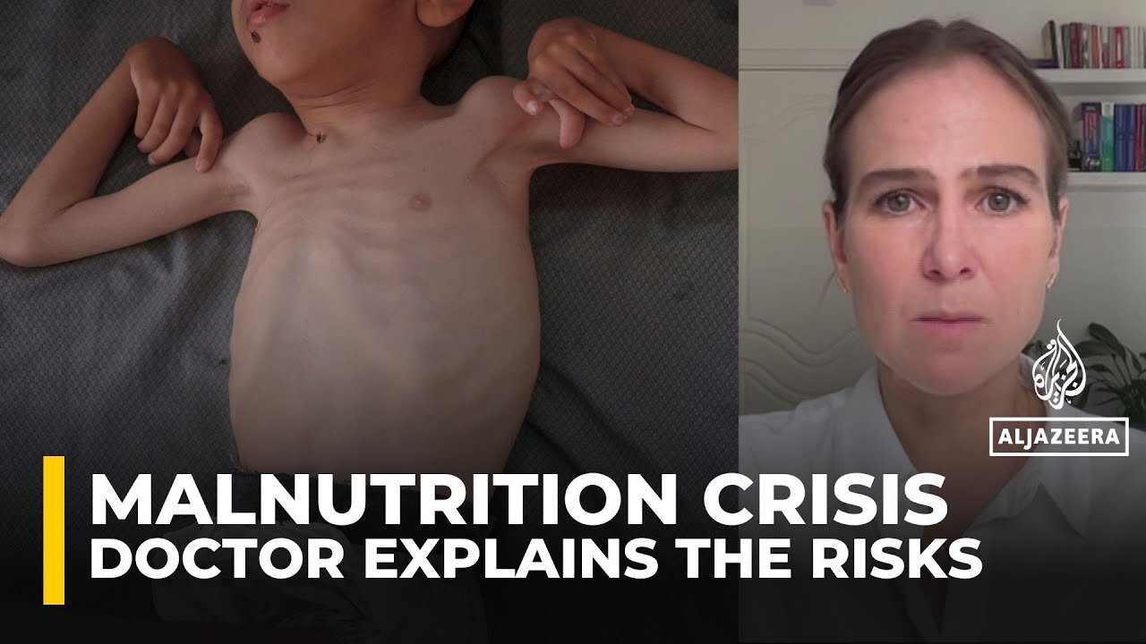 Doctor explains why refeeding malnourished patients can be life-threatening