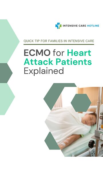 ECMO for Heart Attack Patients Explained