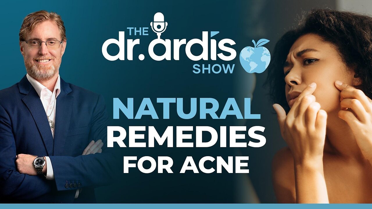 The Dr. Ardis Show | Natural Remedies for Acne | Episode 07.30.2025