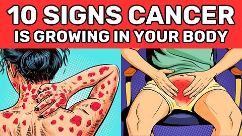 CANCER Survival Guide: 10 Early Warning Signs Everyone Should Know! JN77