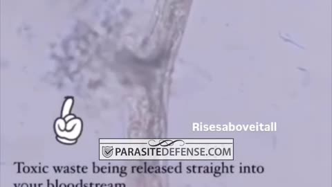 Why you need a Binder when using a Parasite Cleanse