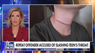 13-year-old survives slashing attack while on family vacation in Florida