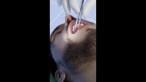 How A Tooth Gets Stuck In Your Sinus #trending