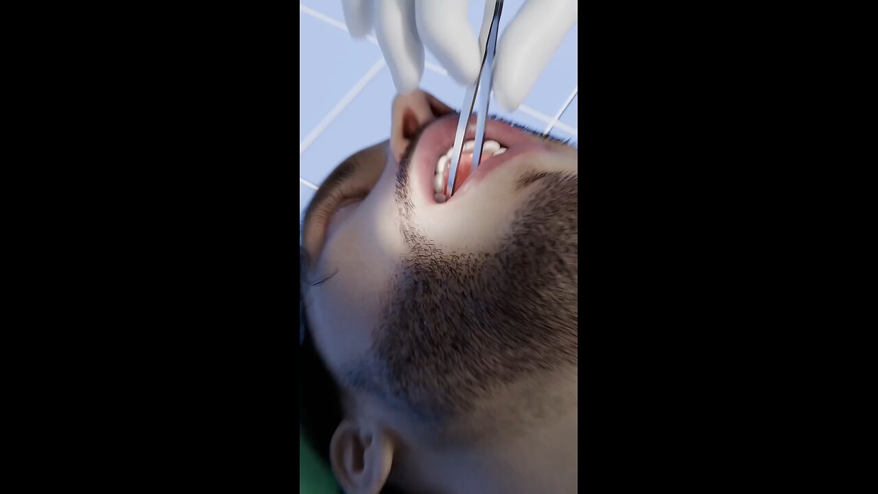How A Tooth Gets Stuck In Your Sinus #trending