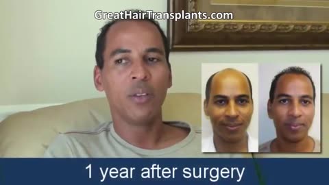Dr. Brett Bolton – Celebrity Hairdresser Discusses Hair Restoration Procedure