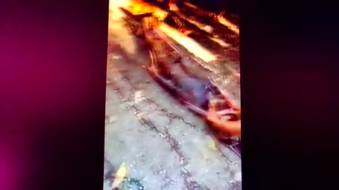 Snake Bite: