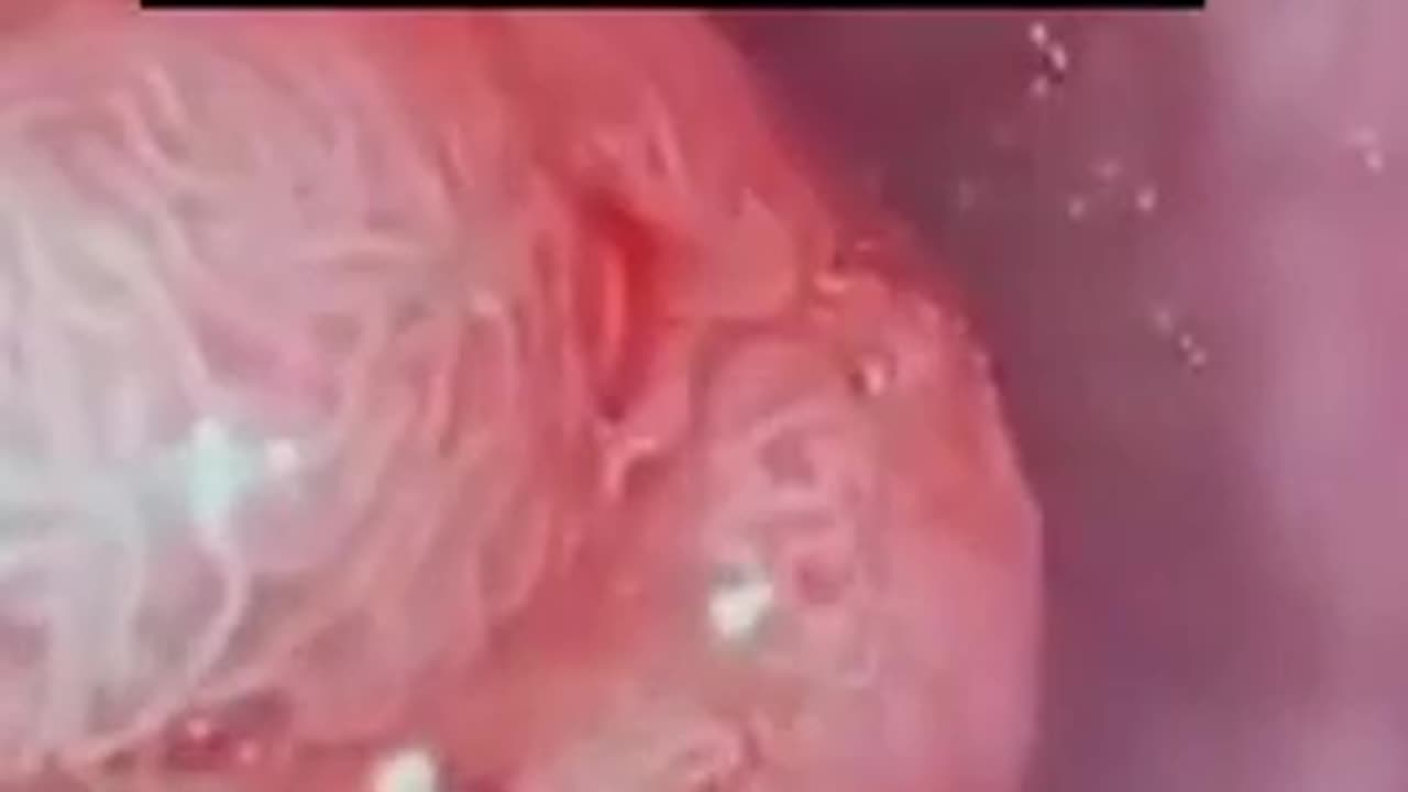 WHAT’S HIDING OUT IN THIS TUMOR: