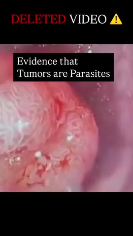WHAT’S HIDING OUT IN THIS TUMOR: