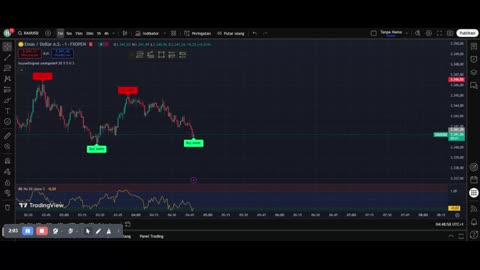 Forex Scalping Strategy for Beginners – Step-by-Step Guide