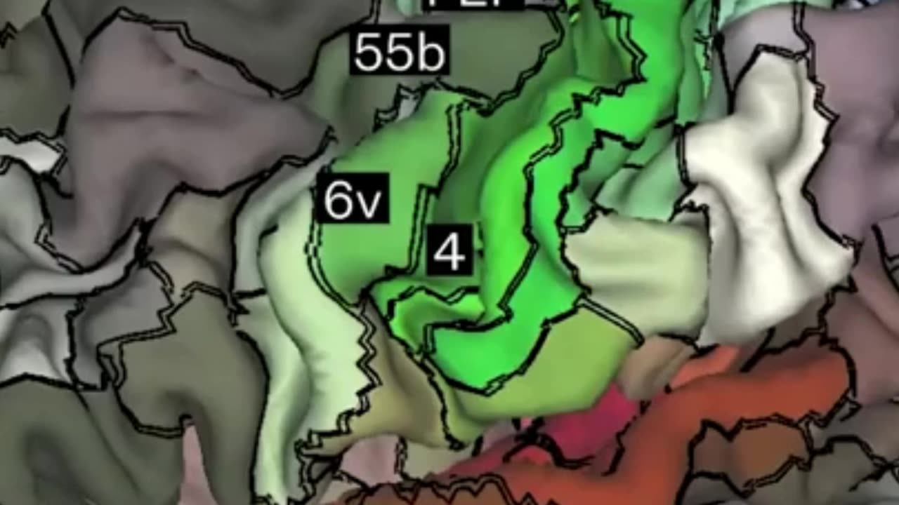 Inside Neuralink’s Cutting-Edge Brain Imaging for Precise Implant Placement!