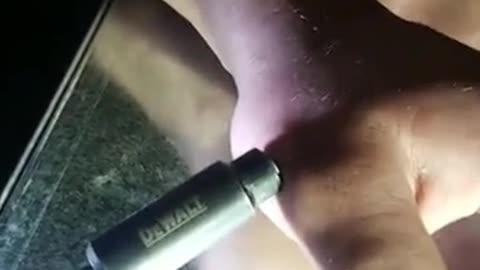 😮🔧 Man Unscrews a Screw from His Hand! | FeedMyCuriosity