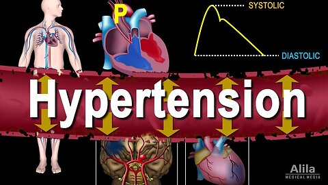 High Blood Pressure Or Hypertension