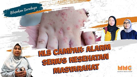 [SURABAYA] KLB Campak: Alarm Serius Kesehatan Masyarakat | Blusukan