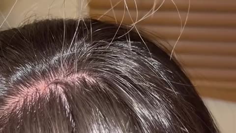 Hair viral