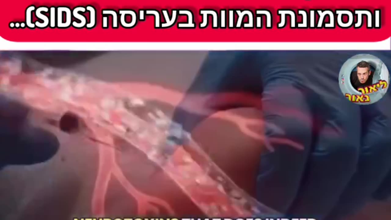 למה הם מזריקים אלומיניום לילדים