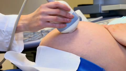 Understanding the In Vitro Fertilization (IVF) Process: A Step by Step Guide