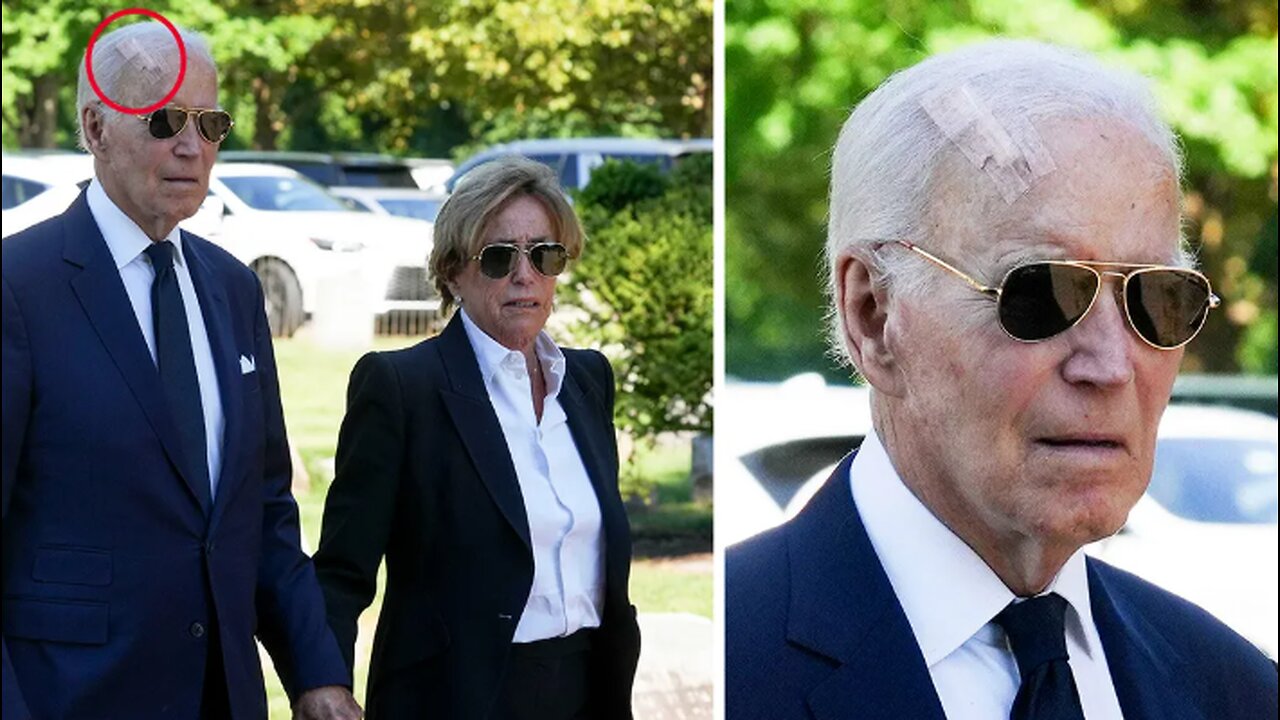 Biden Spotted With Massive Head Scar After Secret Skin Cancer Surgery