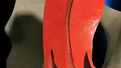 Heavy Periods or Belly Pain Here’s How Doctors Remove Uterine Fibroids Safely!