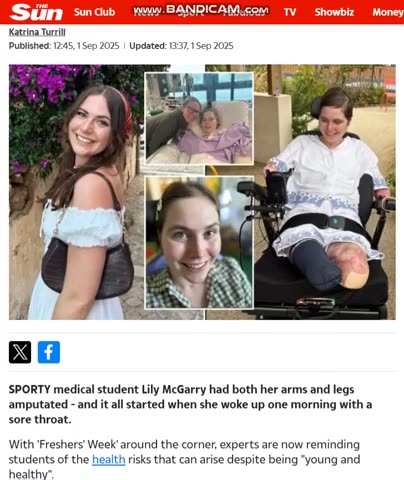 Newly Invented Bug| To Coverup Covid Vaxx Damages= (Stark ‘Fresher’s Flu’)