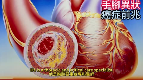 手腳異狀 癌症前兆