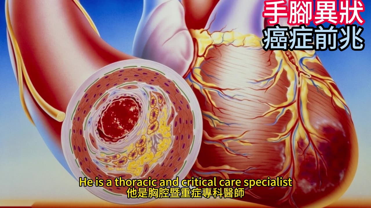 手腳異狀 癌症前兆