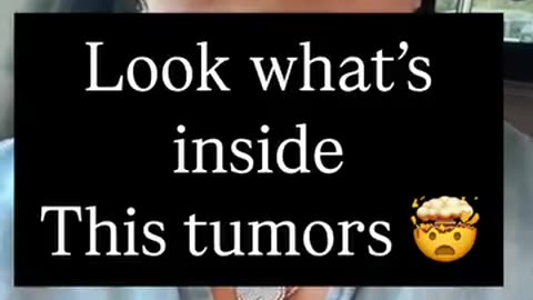 你以為的腫瘤，是細胞變性造成的?不!身在大千世界，各種微生物、小生命充斥著各個方面。