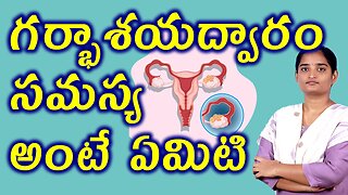 గర్భాశయద్వారం సమస్య అంటే ఏమిటి What Is Cervical Factors Infertility Homeopathy Treatment Medicine