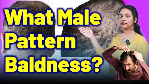 What is Male Pattern Baldness ? |Treatment and Cure| Homeopathy, Medicine