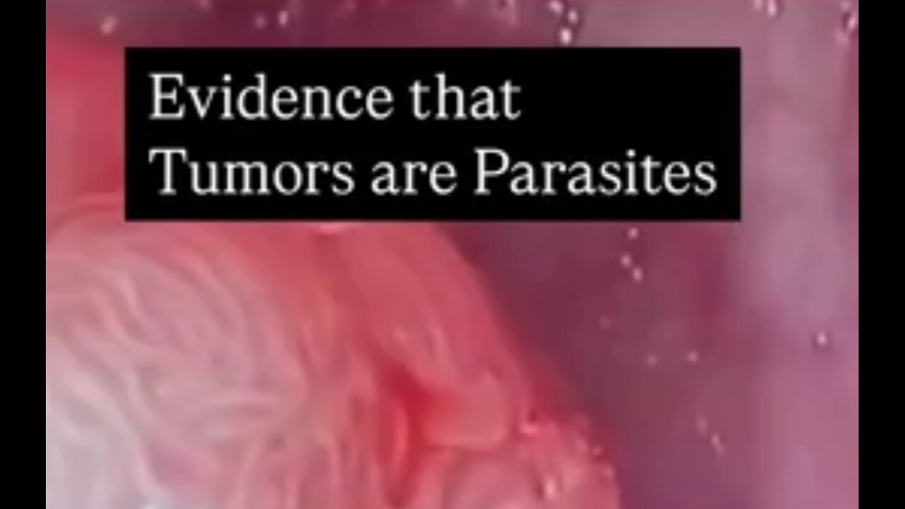 Tumours are Parasites