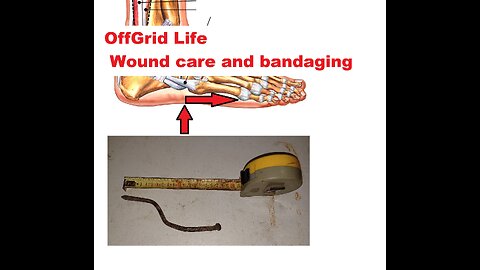 OffGridLife: Wound care and Bandaging