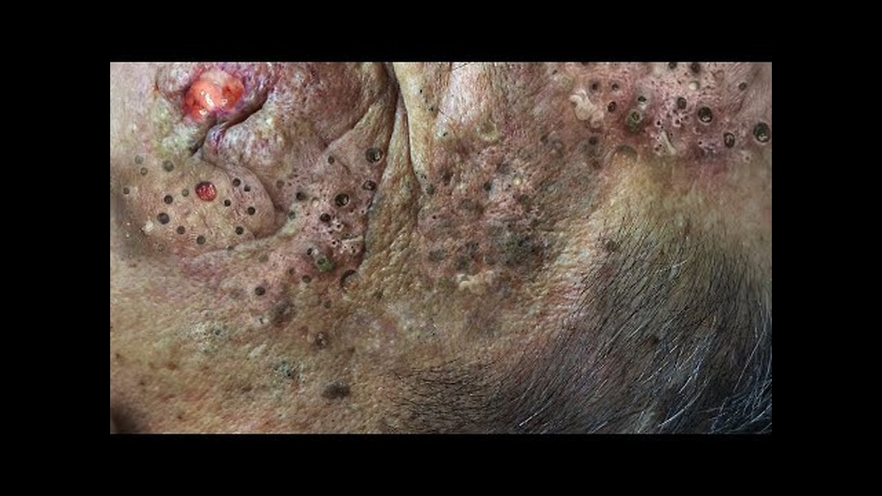 Achieve Inner Peace with These Facial Cleansing spa