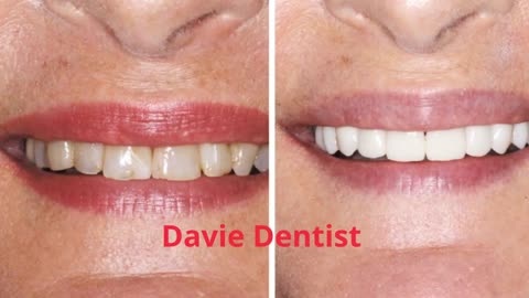 Comfy Smile Dental : Best Dentist in Davie, FL | 954-787-4790