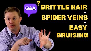 Question from Audience: Brittle Hair, Spider Veins & Easy Bruising
